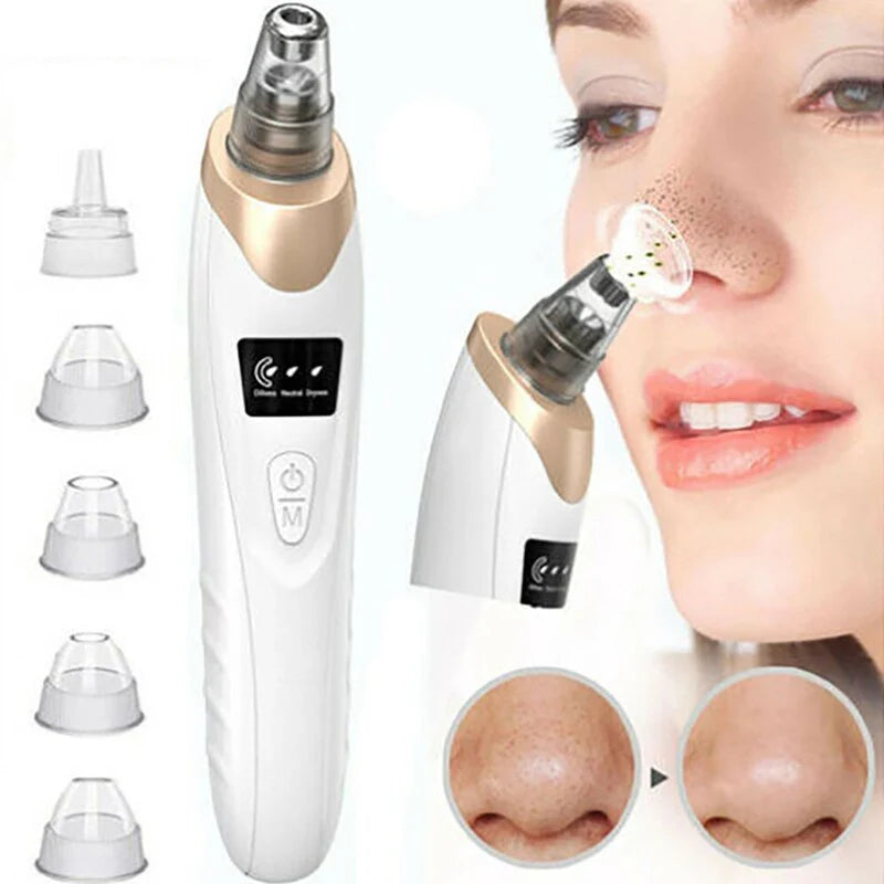 5-in-1 Blackhead Remover